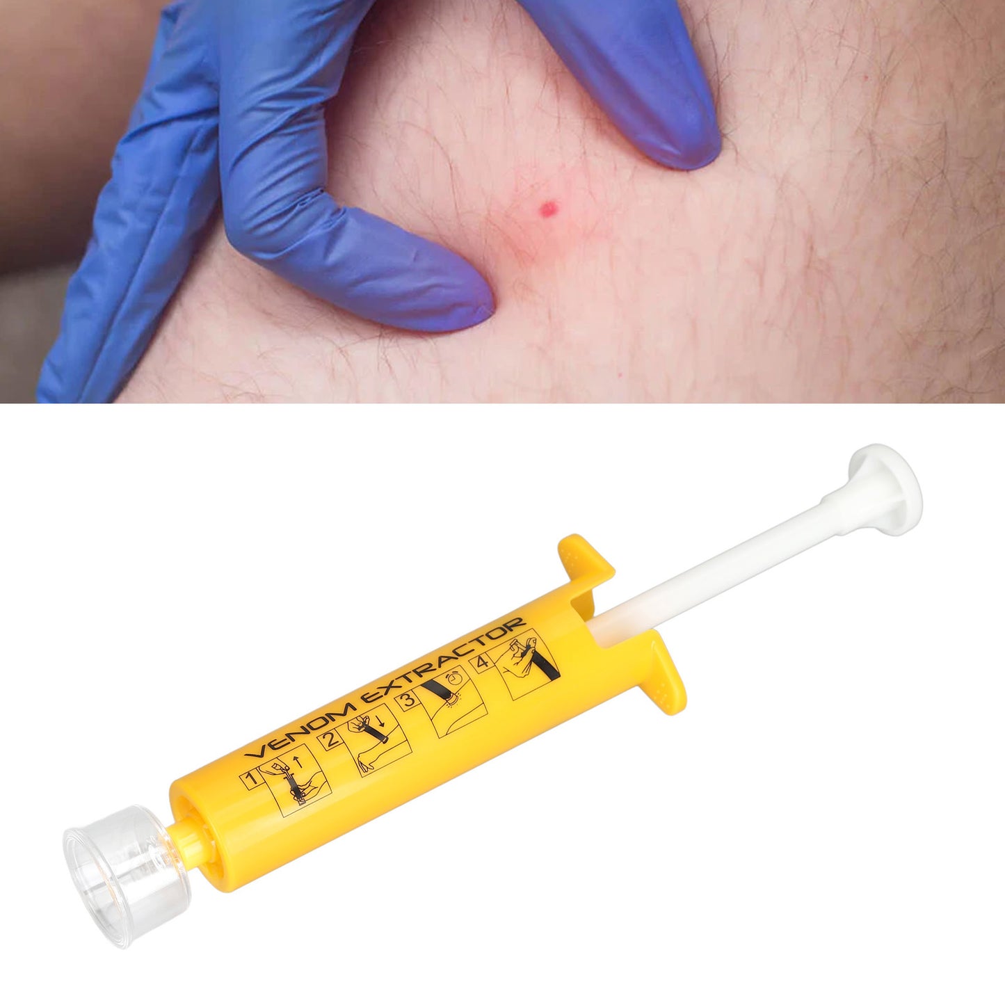 Fast-Acting Bite & Sting Extractor Kit - Emergency Suction Tool