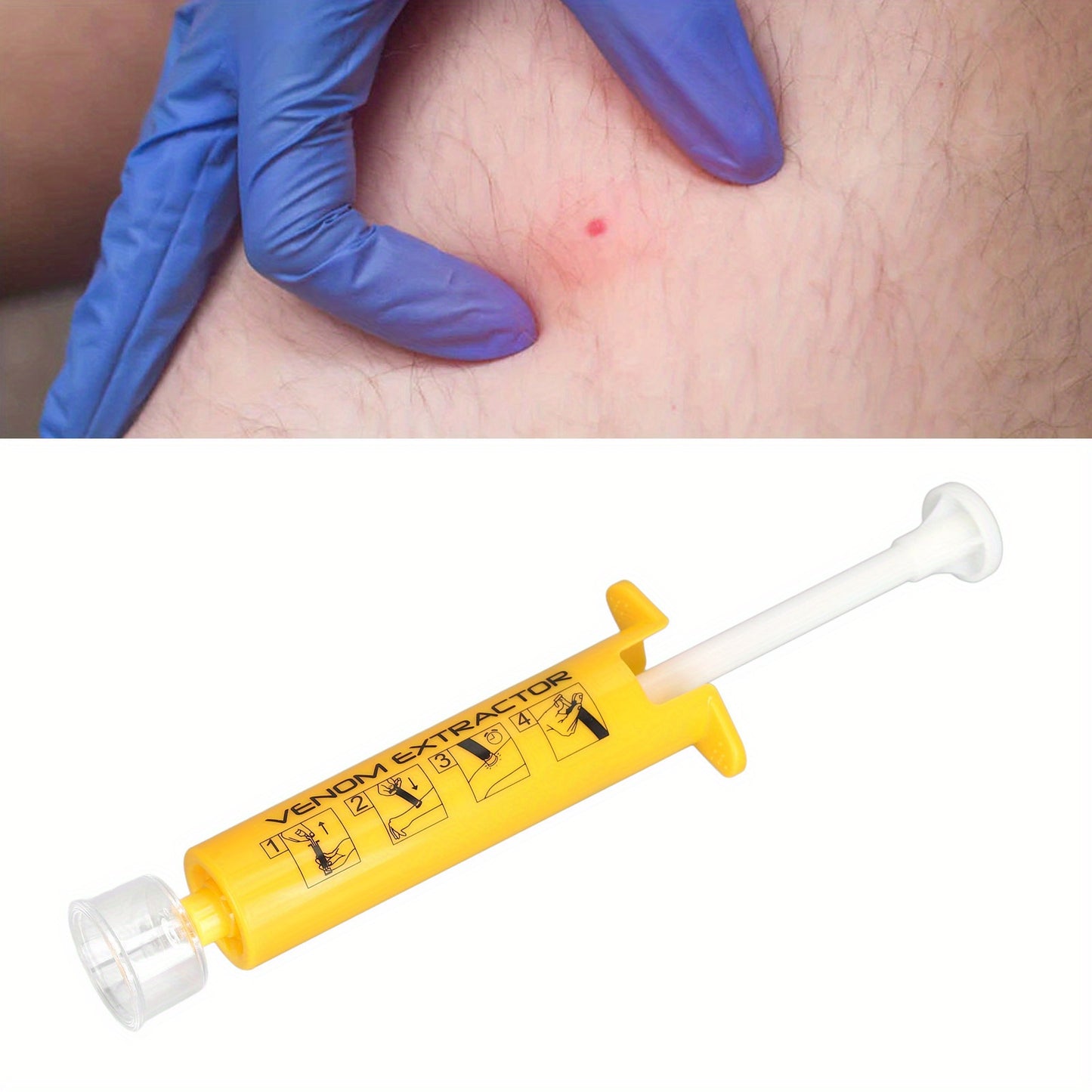 Fast-Acting Bite & Sting Extractor Kit - Emergency Suction Tool